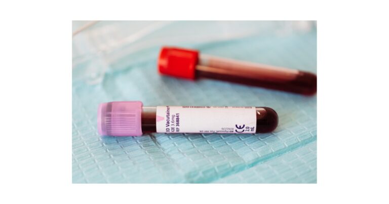 Agios Pharmaceuticals