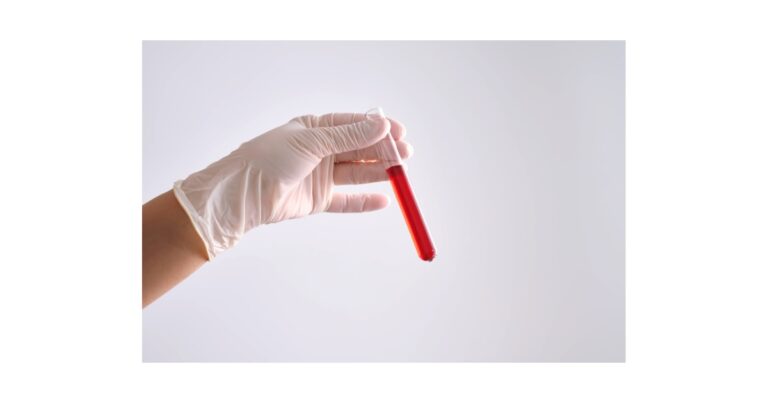 Blood Test