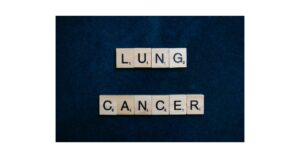 Read more about the article Doctor ne Mahilaon aur Yuvaon me Lung Cancer ke Mamlo me vridhi dekhi hai